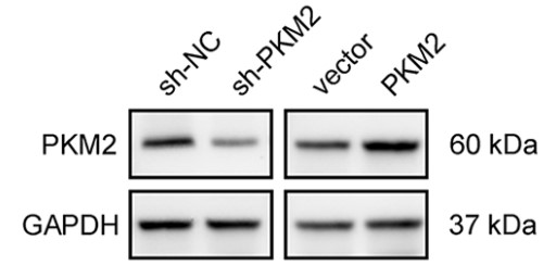 Western blotting analysis of the expression of PKM2.jpg